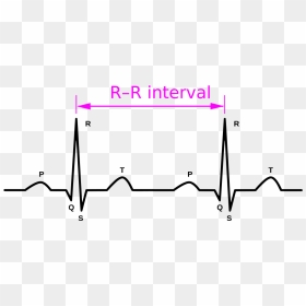 Rr Interval Ecg, HD Png Download - ekg png