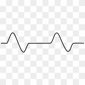 Pulseless Electrical Activity Drawing, HD Png Download - ekg png