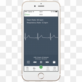 How To Read An Electrocardiogram - Atrial Fibrillation Afib Monitor, HD Png Download - ekg png