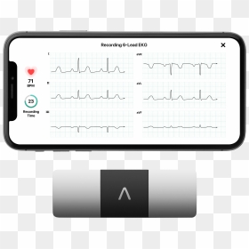 Alivecor Kardiamobile 6l Personal Ekg Monitor, HD Png Download - ekg png