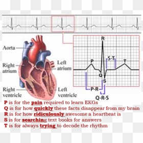24hr Holter Monitor - Third Degree Heart Block Anatomy, HD Png Download - ekg png
