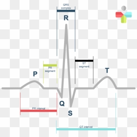 Normal Sinus Rhythm Labeled, HD Png Download - ekg png