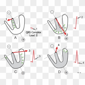 Generation Of Qrs Complex - Heart Depolarization, HD Png Download - ekg png