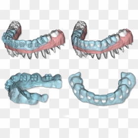 Clear Aligner Maestro 4, HD Png Download - brackets png