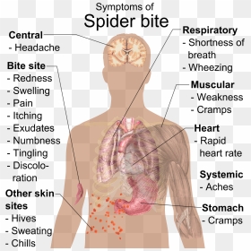 Symptoms Of Spider Bite - Spider Bite Symptoms, HD Png Download - spiders png