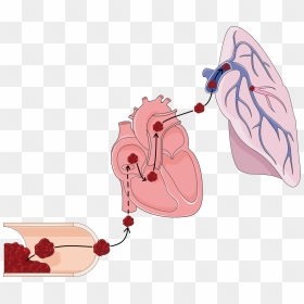 Pulmonary Embolism Png, Transparent Png - lungs png