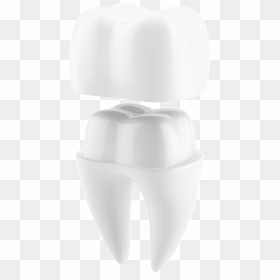 Tooth-crown - Tooth Crowns Png, Transparent Png - silver crown png
