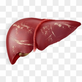 Liver Png Page - Chronic Liver With Hepatitis B, Transparent Png - liver png