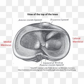 Intra Articular Extra Articular Ligament, HD Png Download - page tear png