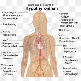 Hypothyroidism Signs, HD Png Download - signs png