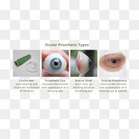 Ocular Prosthesis Types Diagram - Ocular Implant, HD Png Download - eyes lens png