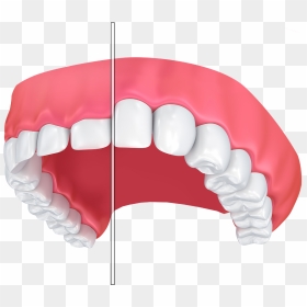 Teeth Before And After Gum Contouring - Gummy Smile Vector, HD Png Download - buck teeth png