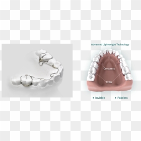 Alf - Cosmetic Dentistry, HD Png Download - buck teeth png