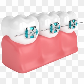 Rayos X De Dientes Brakets, HD Png Download - buck teeth png