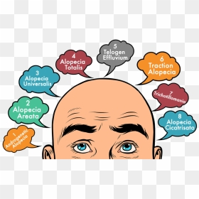 Types Of Hair Loss You Must Learn About - Man With Bald Hair Cartoon, HD Png Download - bald head png