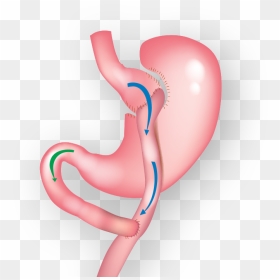 Demonstration Of Gastric Bypass Surgery Clipart , Png - Gastric Bypass Surgery, Transparent Png - stomach png