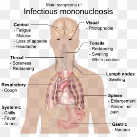 Infectious Mononucleosis, HD Png Download - best png effects