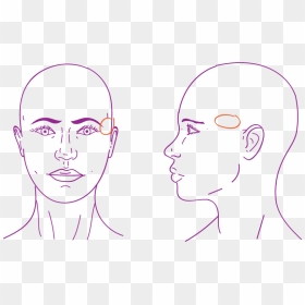 Facial Feminization Of The Temple Area With Lipofilling - Temple Area Of Face, HD Png Download - temples png