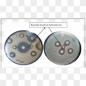 Synergy Between Two Antimicrobials Indicated By Key-hole - Keyhole Effect Antibiotics, HD Png Download - key hole png