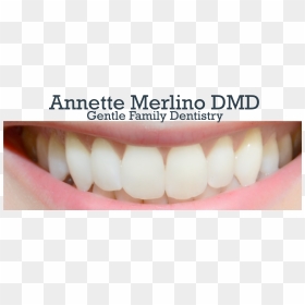 Annette Merlino, Dmd Logo - Tooth, HD Png Download - tooth outline png