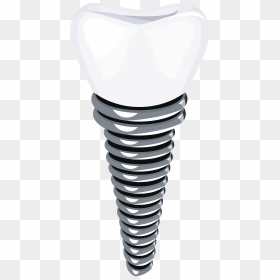 Dental Implant Png Clip Art - Transparent Implant, Png Download - dental png
