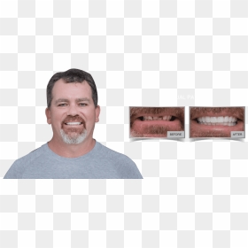 Westcoast International Dental Clinic - Human, HD Png Download - dental png