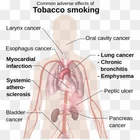 Common Adverse Effects Of Tobacco Smoking, HD Png Download - smoke effects png