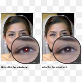 Image Before And After A Red Eye Adjustment - Red Eye, HD Png Download - red eye lens png