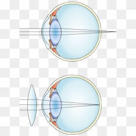 The Eye Is Not Powerful Enough, Or Too Short - We Use Convex Lens In Everyday Life, HD Png Download - blue eye lens png