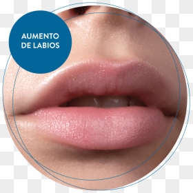 Aumento De Labios, HD Png Download - labios png