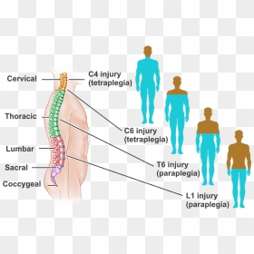 What Is Spinal Cord Injury - Spinal Cord Injury, HD Png Download - spinal cord png