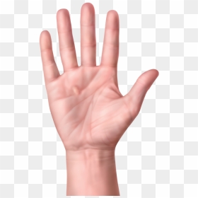 Skin Clipart Hand Palm - Dupuytren's Contracture In Baby, HD Png Download - hand palm png