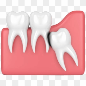 Wisdom Tooth, HD Png Download - teeth.png