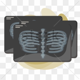 X-ray Of Human Rib Cage V矢量图形 - Illustration, HD Png Download - rib cage png