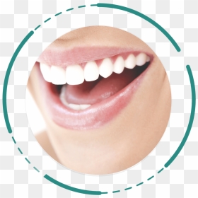 Digital Smile Design - Wisdom Intense White Teeth Whitening Strips, HD Png Download - laughing mouth png