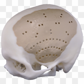 Peek Cranial Implant, HD Png Download - chrome skull png