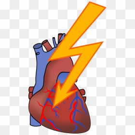 Heart Attack Clipart, HD Png Download - attack icon png