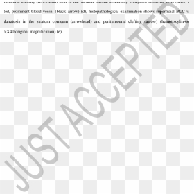 Screenshot, HD Png Download - next arrow png