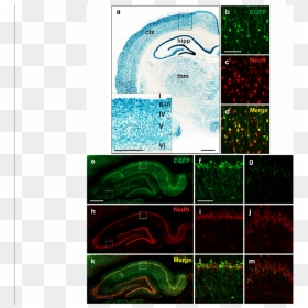 Raprnp Vector Drives Expression In Rat Neurons - Grass, HD Png Download - neurons png