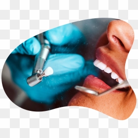 Smiles Forever Of Gardendale - Dentistry, HD Png Download - smiling mouth png