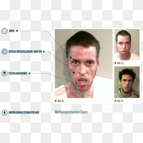 Meth Face, HD Png Download - meth png