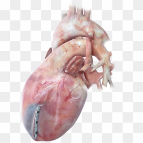 Heart Scar Tissue, HD Png Download - heart attack png