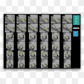 Images/hippocampus Not Zoomed In - Rabbit, HD Png Download - roi png