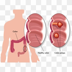 Colon, HD Png Download - colon png