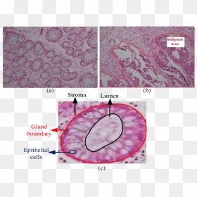 Structure Of Colon Tissue, HD Png Download - colon png