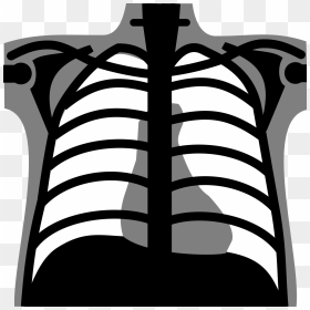 Xray Drawing Baby - Chest X Ray Vector, HD Png Download - xray png