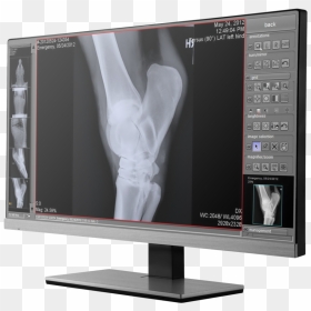 Veterinary X Ray Software, HD Png Download - xray png
