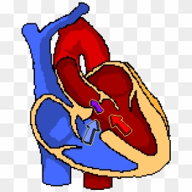 Tetralogy Of Fallot - Clip Art, HD Png Download - crosshair .png