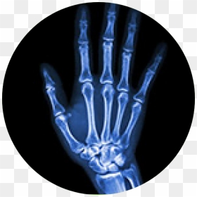 Joint Pain, HD Png Download - flat hand png