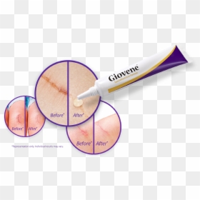 Diagram, HD Png Download - scar texture png
